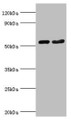Western blot; All lanes: Septin-7 antibody at 9µg/ml; Lane 1: Hela whole cell lysate; Lane 2: Mouse gonad tissue; Secondary; Goat polyclonal to rabbit IgG at 1/10000 dilution; Predicted band size: 51 kDa; Observed band size: 51 kDa;