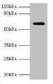 Western blot; All lanes: Anti-Muellerian hormone type-2 receptor antibody at 15µg/ml + Mouse brain tissue; Secondary; Goat polyclonal to rabbit IgG at 1/10000 dilution; Predicted band size: 63, 53, 52 kDa; Observed band size: 63 kDa;
