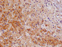 Immunohistochemistry of paraffin-embedded human testis tissue using CAC10575 at dilution of 1:100