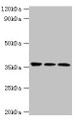 Western blot; All lanes: SLAMF7 antibody at 3µg/ml; Lane 1: Jurkat whole cell lysate; Lane 2: K562 whole cell lysate; Lane 3: Mouse spleen tissue; Secondary; Goat polyclonal to rabbit IgGat 1/10000 dilution; Predicted band size: 38, 26, 18, 33, 23, 22 kDa; Observed band size: 38 kDa