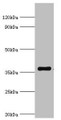 Western blot; All lanes: WDR5 antibody at 2µg/ml + A431 whole cell lysate; Secondary; Goat polyclonal to rabbit IgGat 1/10000 dilution; Predicted band size: 37 kDa; Observed band size: 37 kDa