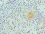 Immunohistochemistry of paraffin-embedded human breast tissue using CAC10579 at dilution of 1:100