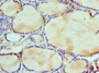 Immunohistochemistry of paraffin-embedded human thyroid tissue using CAC10579 at dilution of 1:100