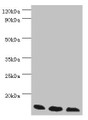 Western blot; All lanes: Transcription elongation factor B polypeptide 2 antibody at 3µg/ml; Lane 1: k562 whole cell lysate; Lane 2: 293T whole cell lysate; Lane 3: HL60 whole cell lysate; Secondary; Goat polyclonal to rabbit IgG at 1/10000 dilution; Predicted band size: 14, 18 kDa; Observed band size: 14 kDa;