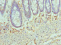 Immunohistochemistry of paraffin-embedded human colon tissue using CAC10585 at dilution of 1:100