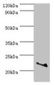 Western blot; All lanes: ASF1A antibody at 2µg/ml + Jurkat whole cell lysate; Secondary; Goat polyclonal to rabbit IgG at 1/10000 dilution; Predicted band size: 23 kDa; Observed band size: 23 kDa