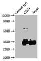 Immunoprecipitating CD74 in Raji whole cell lysate; ,Lane 1: Rabbit control IgG instead in Raji whole cell lysate. For western blotting, a HRP-conjugated Protein G antibody was used as the secondary antibody (1/2000); ,Lane 2: CAC10589 (8µg) + Raji whole cell lysate (500µg); ,Lane 3: Raji whole cell lysate (10µg)