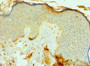 Immunohistochemistry of paraffin-embedded human skin tissue using CAC10591 at dilution of 1:100