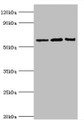 Western blot; All lanes: Interleukin-10 receptor subunit alpha antibody at 8µg/ml; Lane 1: Mouse heart tissue; Lane 2: Hela whole cell lysate; Lane 3: Mouse liver tissue; Secondary; Goat polyclonal to rabbit IgG at 1/10000 dilution; Predicted band size: 63 kDa; Observed band size: 63 kDa;