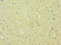 Immunohistochemistry of paraffin-embedded human brain tissue using CAC10611 at dilution of 1:100