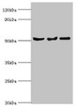 Western blot; All lanes: Protein Z-dependent protease inhibitor antibody at 3µg/ml; Lane 1: Mouse liver tissue; Lane 2: HepG2 whole cell lysate; Lane 3: LO2 whole cell lysate; Secondary; Goat polyclonal to rabbit IgG at 1/10000 dilution; Predicted band size: 51 kDa; Observed band size: 51 kDa;