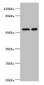 Western blot; All lanes: STK3 antibody at 8µg/ml; Lane 1: Hela whole cell lysate; Lane 2: NIH/3T3 whole cell lysate; Secondary; Goat polyclonal to rabbit IgG at 1/10000 dilution; Predicted band size: 57, 60 kDa; Observed band size: 57 kDa