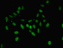 Immunofluorescent analysis of Hela cells using CAC10627 at dilution of 1:100 and Alexa Fluor 488-congugated AffiniPure Goat Anti-Rabbit IgG(H+L)