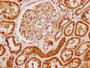 IHC image diluted at 1:121 and staining in paraffin-embedded human kidney tissue performed on a Leica BondTM system. After dewaxing and hydration, antigen retrieval was mediated by high pressure in a citrate buffer (pH 6.0). Section was blocked with 10% normal goat serum 30min at RT. Then primary antibody (1% BSA) was incubated at 4°C overnight. The primary is detected by a biotinylated secondary antibody and visualized using an HRP conjugated SP system.