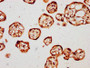 IHC image diluted at 1:121 and staining in paraffin-embedded human placenta tissue performed on a Leica BondTM system. After dewaxing and hydration, antigen retrieval was mediated by high pressure in a citrate buffer (pH 6.0). Section was blocked with 10% normal goat serum 30min at RT. Then primary antibody (1% BSA) was incubated at 4°C overnight. The primary is detected by a biotinylated secondary antibody and visualized using an HRP conjugated SP system.