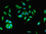 Immunofluorescent analysis of Hela cells using CAC10629 at dilution of 1:100 and Alexa Fluor 488-congugated AffiniPure Goat Anti-Rabbit IgG(H+L)