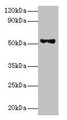 Western blot; All lanes: Patatin-like phospholipase domain-containing protein 3 antibody at 8µg/ml + HepG2 whole cell lysate; Secondary; Goat polyclonal to rabbit IgG at 1/10000 dilution; Predicted band size: 53 kDa; Observed band size: 53 kDa;