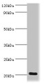 Western blot; All lanes: Prion-like protein doppel antibody at 2µg/ml + Mouse spleen tissue; Secondary; Goat polyclonal to rabbit IgG at 1/10000 dilution; Predicted band size: 20 kDa; Observed band size: 20 kDa;