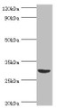 Western blot; All lanes: Tumor necrosis factor ligand superfamily member 13B antibody at 2µg/ml + Mouse liver tissue; Secondary; Goat polyclonal to rabbit IgG at 1/10000 dilution; Predicted band size: 32, 30, 18 kDa; Observed band size: 32 kDa;