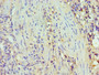 Immunohistochemistry of paraffin-embedded human epityphlon tissue using CAC10633 at dilution of 1:100