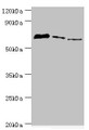 Western blot; All lanes: Tyrosyl-DNA phosphodiesterase 1 antibody at 8µg/ml; Lane 1: MCF-7 whole cell lysate; Lane 2: Mouse lung tissue; Lane 3: Rat brain tissue; Secondary; Goat polyclonal to rabbit IgG at 1/10000 dilution; Predicted band size: 69, 42 kDa; Observed band size: 69 kDa;