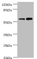 Western blot; All lanes: Non-syndromic hearing impairment protein 5 antibody at 10µg/ml; Lane 1: Hela whole cell lysate; Lane 2: HepG2 whole cell lysate; Secondary; Goat polyclonal to rabbit IgG at 1/10000 dilution; Predicted band size: 55, 11, 37 kDa; Observed band size: 55 kDa;