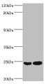 Western blot; All lanes: RAN antibody at 2µg/ml; Lane 1: Hela whole cell lysate; Lane 2: Jurkat whole cell lysate; Secondary; Goat polyclonal to rabbit IgG at 1/10000 dilution; Predicted band size: 24 kDa; Observed band size: 24 kDa