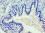 Immunohistochemistry of paraffin-embedded human lung tissue using CAC10639 at dilution of 1:100