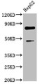 Western Blot; , Positive WB detected in: HepG2 whole cell lysate; , All lanes: DVL2 antibody at 2.3µg/ml; , Secondary; , Goat polyclonal to rabbit IgG at 1/50000 dilution; , Predicted band size: 79 kDa; , Observed band size: 79 kDa