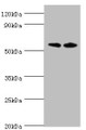 Western blot; All lanes: Alkaline phosphatase, placental type antibody at 8µg/ml; Lane 1: A549 whole cell lysate; Lane 2: Hela whole cell lysate; Secondary; Goat polyclonal to rabbit IgG at 1/10000 dilution; Predicted band size: 58 kDa; Observed band size: 58 kDa;