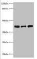 Western blot; All lanes: Alpha-2, 8-sialyltransferase 8B antibody at 8µg/ml; Lane 1: Mouse heart tissue; Lane 2: HepG2 whole cell lysate; Lane 3: Mouse kidney tissue; Secondary; Goat polyclonal to rabbit IgG at 1/10000 dilution; Predicted band size: 42 kDa; Observed band size: 42 kDa;