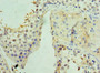 Immunohistochemistry of paraffin-embedded human testis tissue using CAC10642 at dilution of 1:100