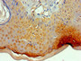 Immunohistochemistry of paraffin-embedded human skin tissue using CAC10644 at dilution of 1:100