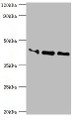 Western blot; All lanes: Apolipoprotein L1 antibody at 10µg/ml; Lane 1: A549 whole cell lysate; Lane 2: Hela whole cell lysate; Lane 3: HepG2 whole cell lysate; Secondary; Goat polyclonal to rabbit IgG at 1/10000 dilution; Predicted band size: 44, 46, 43 kDa; Observed band size: 44 kDa;