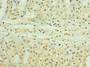 Immunohistochemistry of paraffin-embedded human adrenal gland tissue using CAC10652 at dilution of 1:100