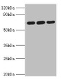 Western blot; All lanes: ATAD3A antibody at 4µg/ml; Lane 1: A549 whole cell lysate; Lane 2: Mouse spleen tissue; Lane 3: Mouse liver tissue; Secondary; Goat polyclonal to rabbit IgG at 1/10000 dilution; Predicted band size: 72, 67, 58 kDa; Observed band size: 72 kDa;