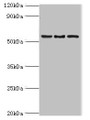 Western blot; All lanes: ARFGAP3 antibody at 4µg/ml; Lane 1: HepG2 whole cell lysate; Lane 2: Jurkat whole cell lysate; Lane 3: A549 whole cell lysate; Secondary; Goat polyclonal to rabbit IgG at 1/10000 dilution; Predicted band size: 57, 52 kDa; Observed band size: 57 kDa;