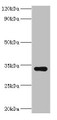 Western blot; All lanes: HYLS1 antibody at 8µg/ml + Hela whole cell lysate; Secondary; Goat polyclonal to rabbit IgG at 1/10000 dilution; Predicted band size: 34 kDa; Observed band size: 34 kDa;