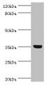 Western blot; All lanes: GLYATL1 antibody at 8µg/ml + Rat liver tissue; Secondary; Goat polyclonal to rabbit IgG at 1/10000 dilution; Predicted band size: 36, 39 kDa; Observed band size: 36 kDa;