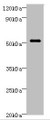 Western blot; All lanes: STARD3 Antibody at 6µg/ml + MCF-7 whole cell lysate; Secondary; Goat polyclonal to rabbit IgG at 1/10000 dilution; Predicted band size: 51, 49, 50 kDa; Observed band size: 51 kDa;