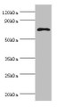 Western blot; All lanes: MSLN antibody at 8µg/ml + Hela whole cell lysate; Secondary; Goat polyclonal to rabbit IgG at 1/10000 dilution; Predicted band size: 69, 72, 68 kDa; Observed band size: 69 kDa