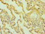 Immunohistochemistry of paraffin-embedded human lung tissue using CAC10688 at dilution of 1:100