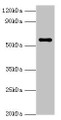 Western blot; All lanes: NAB2 antibody at 3µg/ml + Hela whole cell lysate; Secondary; Goat polyclonal to rabbit IgG at 1/10000 dilution; Predicted band size: 57, 35, 50 kDa; Observed band size: 57 kDa