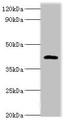 Western blot; All lanes: PARL antibody at 6µg/ml + NIH/3T3 whole cell lysate; Secondary; Goat polyclonal to rabbit IgG at 1/10000 dilution; Predicted band size: 43, 37 kDa; Observed band size: 47 kDa;