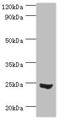 Western blot; All lanes: Mitotic spindle assembly checkpoint protein MAD2A antibody at 3µg/ml + 293T whole cell lysate; Secondary; Goat polyclonal to rabbit IgG at 1/10000 dilution; Predicted band size: 24, 11 kDa; Observed band size: 24 kDa;