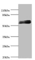 Western blot; All lanes: GABRR1 antibody at 1.25µg/ml + Mouse eye tissue; Secondary; Goat polyclonal to rabbit IgG at 1/10000 dilution; Predicted band size: 56, 54, 46 kDa; Observed band size: 56 kDa;