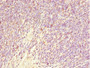 Immunohistochemistry of paraffin-embedded human thymus tissue using CAC10701 at dilution of 1:100