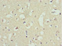 Immunohistochemistry of paraffin-embedded human brain tissue using CAC10702 at dilution of 1:100