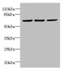 Western blot; All lanes: INTS11 antibody at 2µg/ml; Lane 1: Colo320 whole cell lysate; Lane 2: Hela whole cell lysate; Lane 3: MCF-7 whole cell lysate; Secondary; Goat polyclonal to Rabbit IgG at 1/10000 dilution; Predicted band size: 68, 57, 66, 65, 69 kDa; Observed band size: 68 kDa