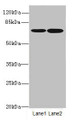 Western blot; All lanes: SLC23A2antibody at 3.16µg/ml; Lane 1: SH-SY5Y whole cell lysate; Lane 2: A375 whole cell lysate; Secondary; Goat polyclonal to rabbit IgG at 1/10000 dilution; Predicted band size: 71, 59 kDa; Observed band size: 71 kDa;